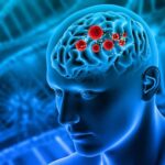 Amoebic Meningitis