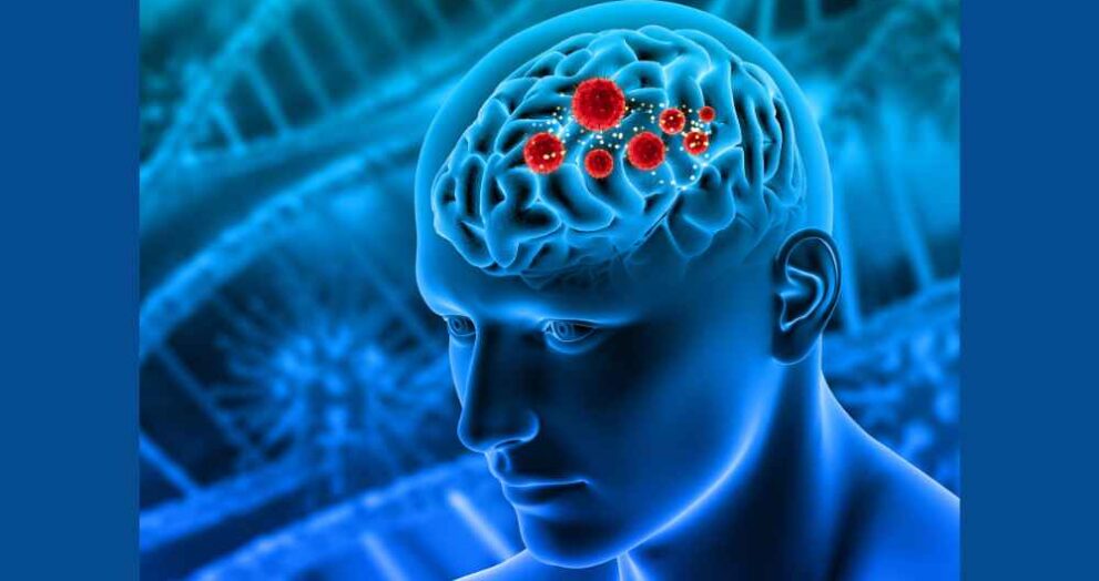Amoebic Meningitis