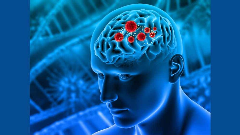 Amoebic Meningitis