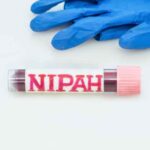 Nipah Virus