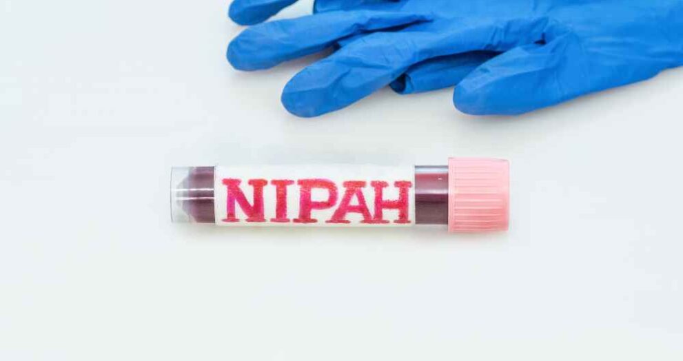 Nipah Virus