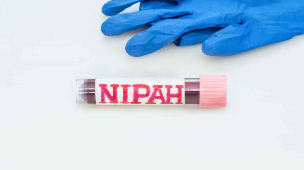Nipah Virus